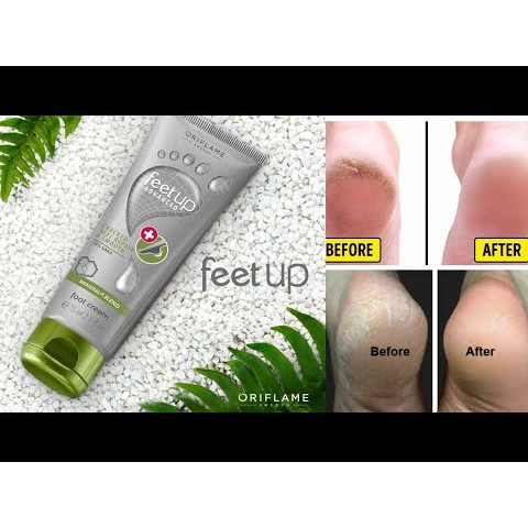 33027 KEM DƯỠNG DA CHÂN - FEET UP ADVANCED CRACKED HEEL REPAIR & SMOOTH FOOT CREAm