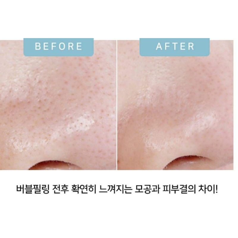 Tẩy da chết dạng bọt lợi khuẩn GREEN LACTO BUBBLE PEELING