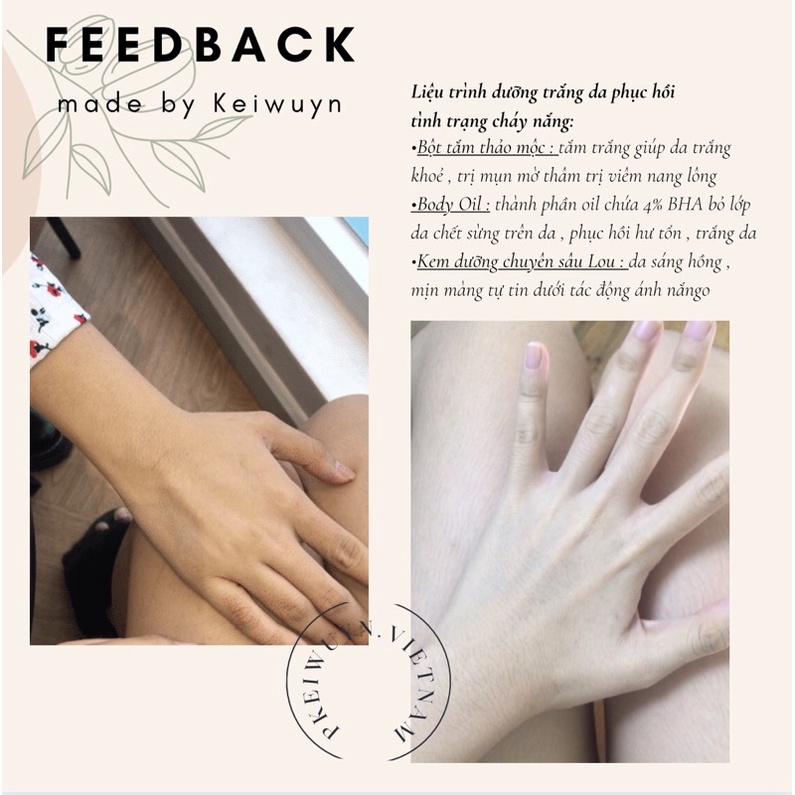 Lou Cream from Keiwuyn ( SẢN PHẨM BEST SELLER CỦA SHOP ) | BigBuy360 - bigbuy360.vn