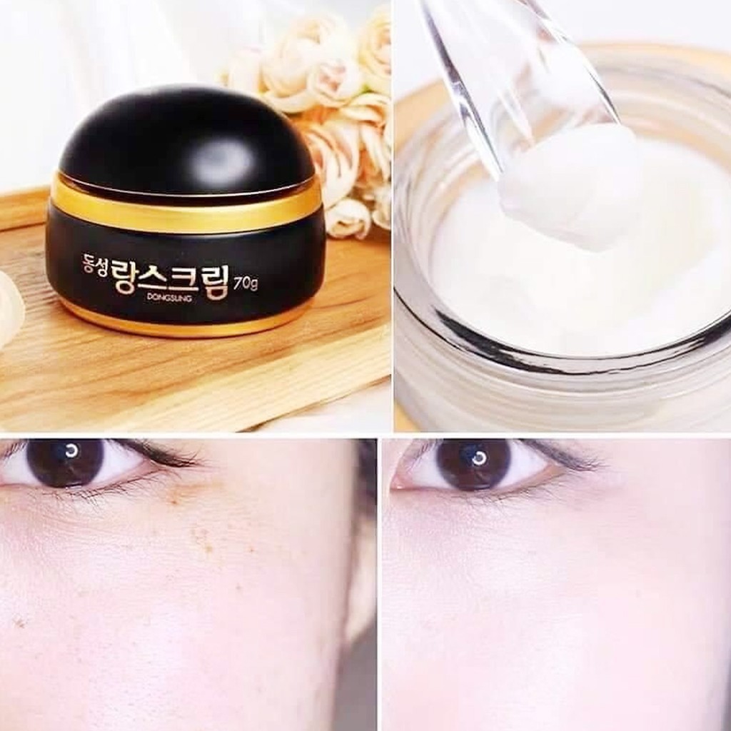 Kem Dưỡng Trắng Da, Mờ Nám Chiết Xuất Từ Hoa Cúc La Mã DongSung Rannce Cream 10g - Viebeauty