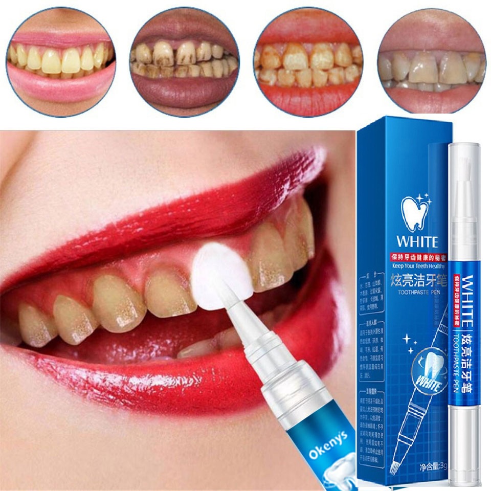 BÚT TẨY TRẮNG RĂNG NHƯ TUYẾT, VÀNG ĐEN ĐẾN MẤY CŨNG TRẮNG