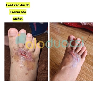 Xịt kháng khuẩn Maxibac ( bộ đôi xịt + gel maxibac)