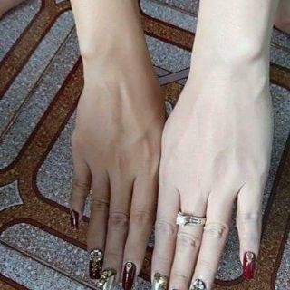 KEM BODY CHIEE TRẮNG NHANH