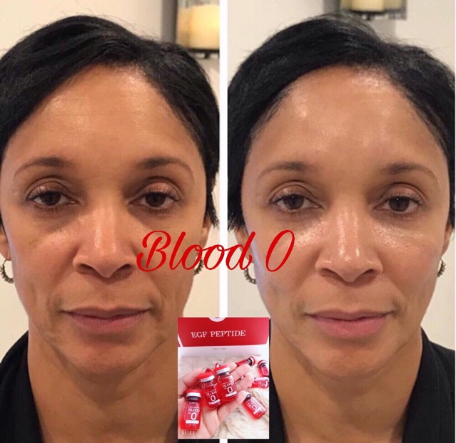 Blood O - Siêu Tế Bào Gốc Máu - Huyết Tương Tiểu Cầu [ 1 Hộp 15 Ống ] blood type O