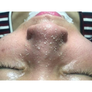Mặt nạ good bye blackhead ciracle