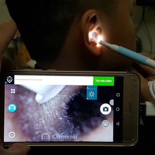 COMBO 5 LẤY RÁY TAI CÓ ĐÈN  FLASHLIGHT EARPICK