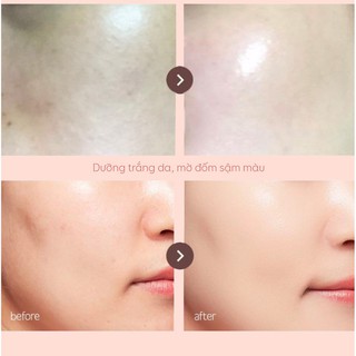 SERUM  ALPHA ARBUTIN