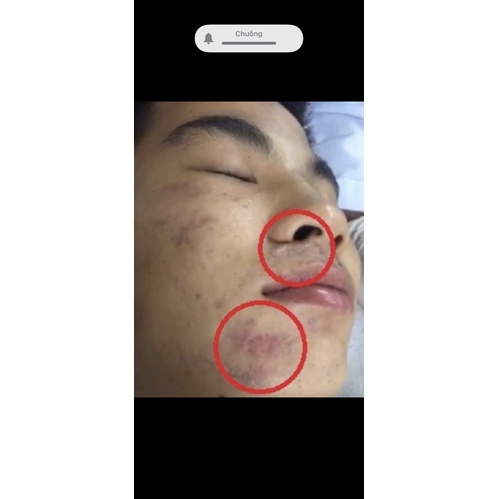 Kem Mờ Sẹo Thâm Sẹo Lõm Và Sẹo Rỗ Của Mỹ Scar Esthetique 30ml- Rejuvaskin