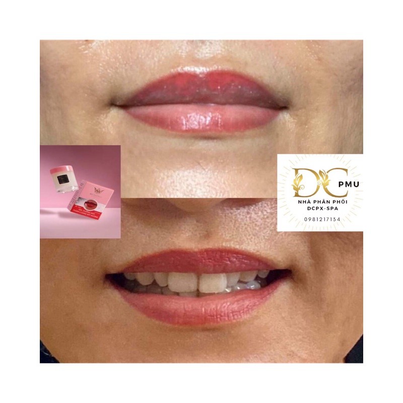 Dưỡng môi thâm loang