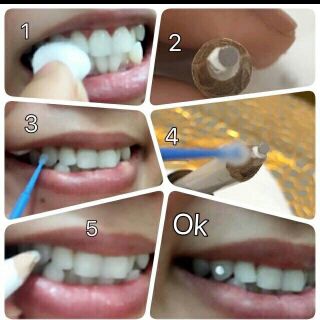 Keo đính đá lớn