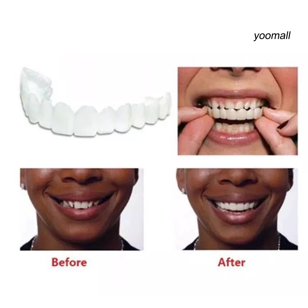 [Hàng mới về] Bộ 2 hàm răng giả tự nhiên chất lượng cao chuyên dụng