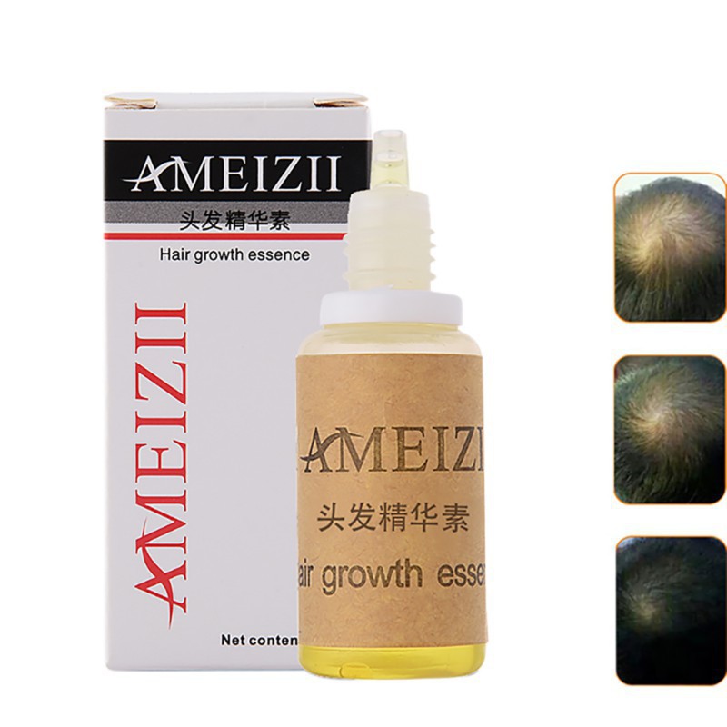 Tinh chất tăng trưởng và nuôi dưỡng tóc AMEIZII 200ml chất lượng cao | BigBuy360 - bigbuy360.vn