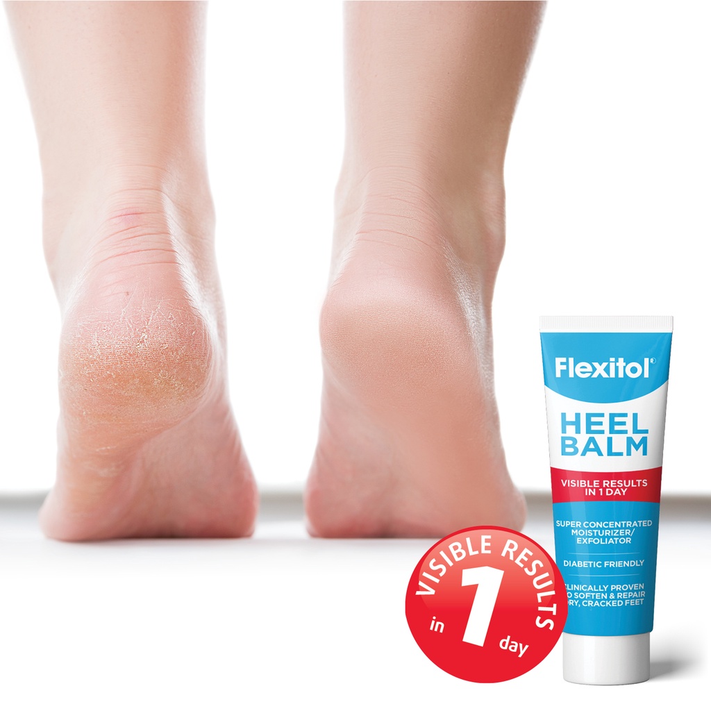 Heel Balm flexitol Kem làm liền nứt nẻ bàn chân, nứt nẻ gót chân, Hiệu quả sau 1 ngày, 112gam, USA