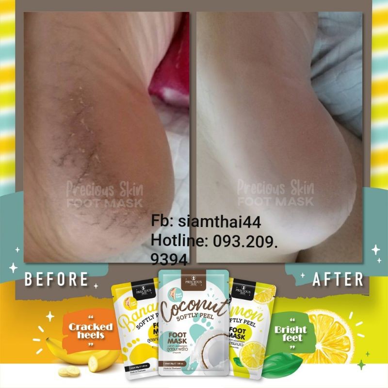 (Lẻ 1 Gói) Mặt Nạ Chân SOFTLY PEEL FOOT MASK BY PRECIOUS SKIN | BigBuy360 - bigbuy360.vn