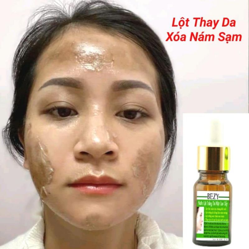 Lột Bong Da Mặt Trắng Da Nam Nữ Bezy