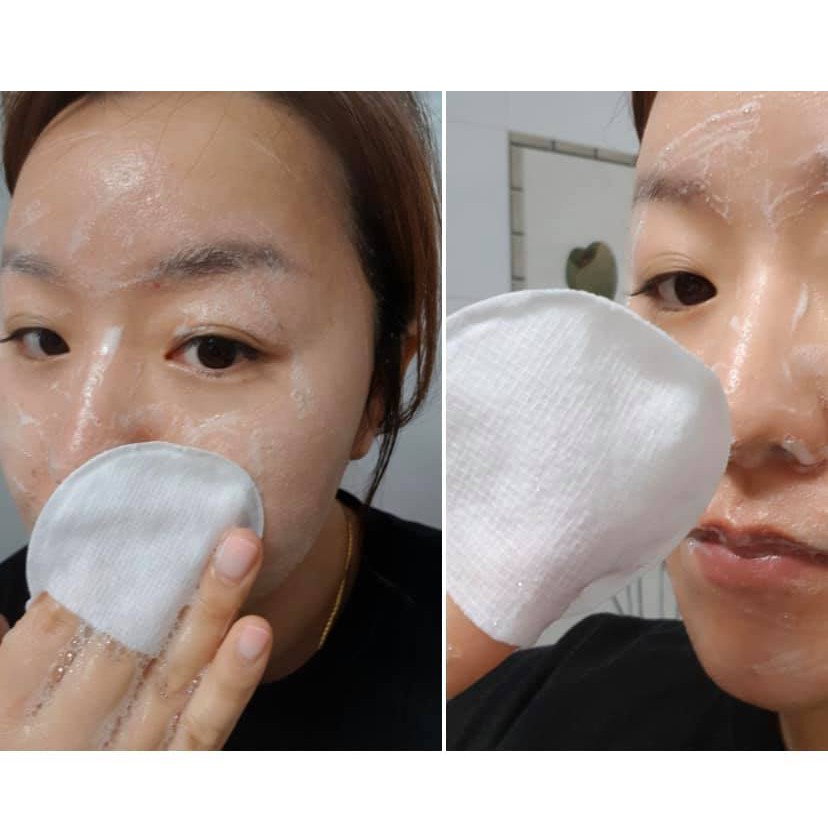 Miếng pad rửa mặt Soft & Peel Bubble Fast Pads Prreti | BigBuy360 - bigbuy360.vn