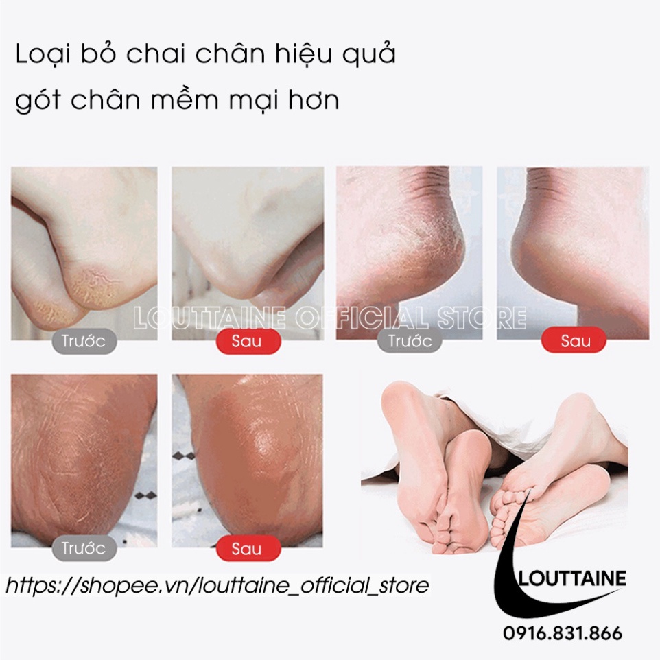 Cây bào nạo gót chân giá rẻ - Dụng cụ chà gót chân và vết chai sần 2in1 kèm 20 lưỡi cạo tiện lợi