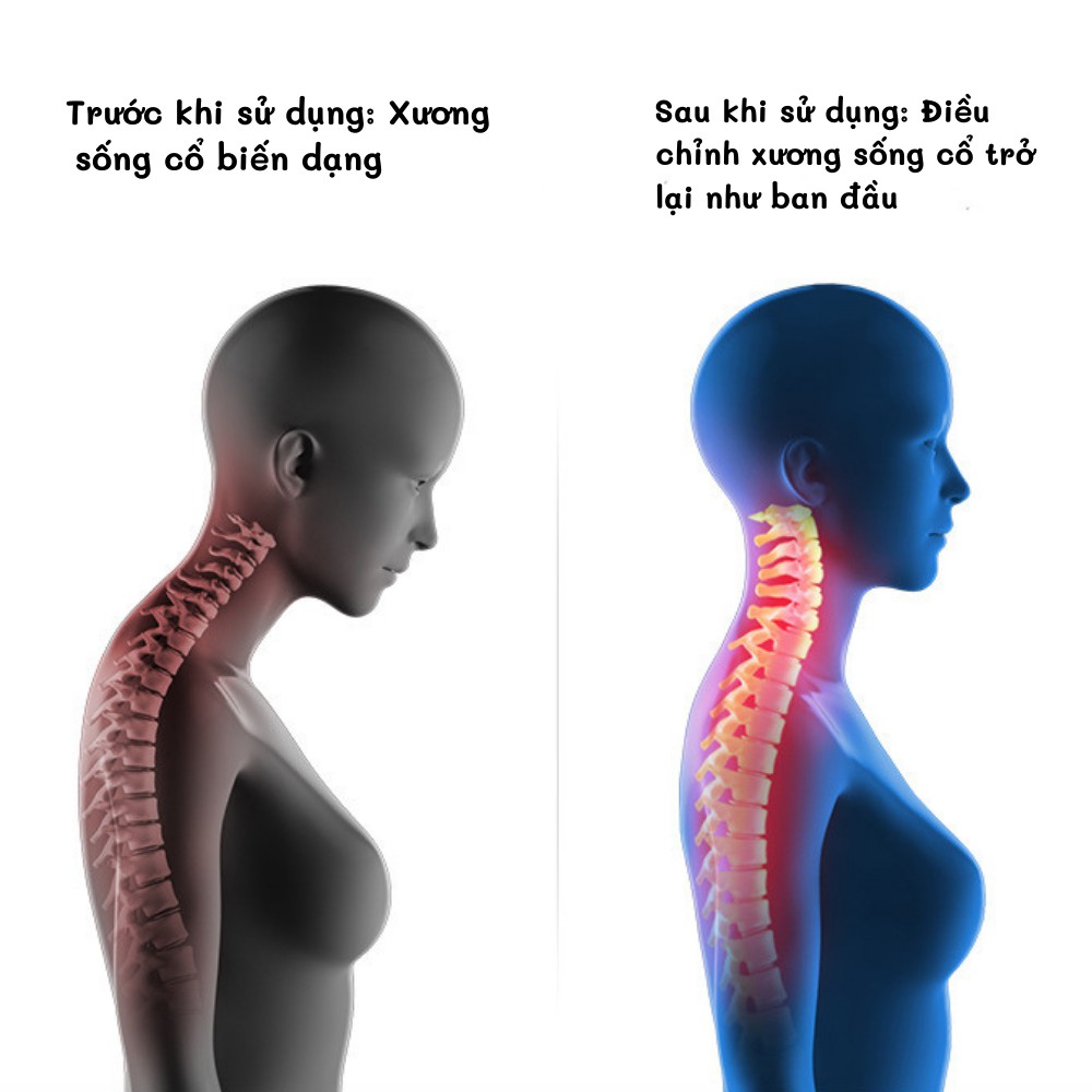 Máy massage cổ vai gáy trị liệu [Loại 1] xung điện cao cấp giảm đau mỏi cổ vai gáy lưu thông máu giảm căng thẳng