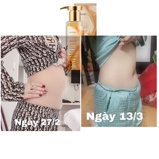 Gel phá mỡ x5 slimlux của soherbs
