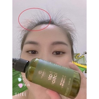 XỊT BƯỞI MỌC TÓC 𝑽𝑰𝑱𝑼𝑳𝑳𝒀  chai 100ml