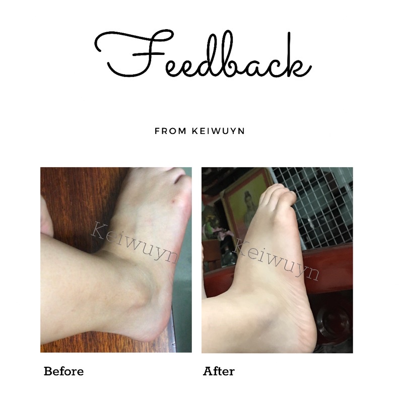 Refreshing Cream from Keiwuyn ( bản cải tiến ) | BigBuy360 - bigbuy360.vn