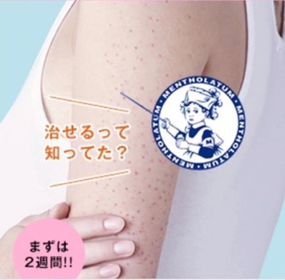 Trị viêm chân lông Nhật Bản