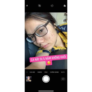 TINH CHẤT DIỆT MỤN 24H HERRIN CARE