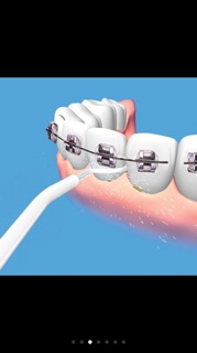 Tăm nước răng miệng cao cấp