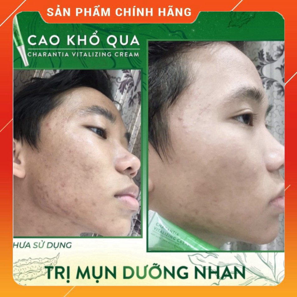 Cao Khổ Qua Dành Cho Da Mụn soHERBs 10ml