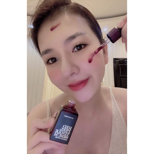 Gói sample dùng thư RED PEEl SERUM So’natural | BigBuy360 - bigbuy360.vn