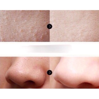Serum se khít lỗ chân lông