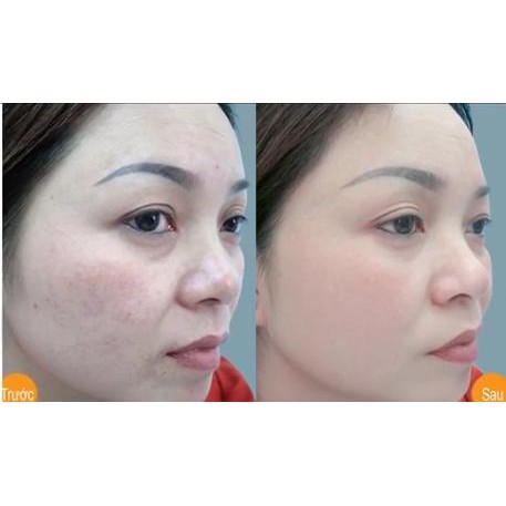 [ CHÍNH HÃNG ] Kem Làm Sáng Đều Màu Da, Giảm Thâm, Nám, Sạm, Tàn Nhang -  FIXDERMA EPIFAGER RAGALE CREAM 30G