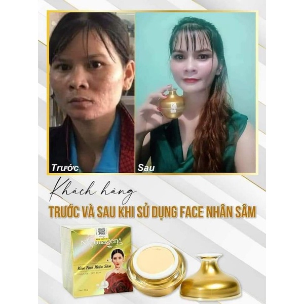 KEM FACE NHÂN SÂM N_COLAGEN