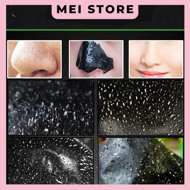 Gel lột Mụn Than Tre HANKEY Bamboo Charcoal Sạch mụn - Thải độc chì- Sáng da 70gr