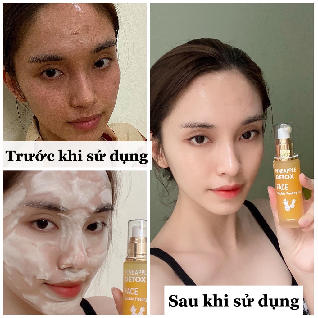 [FreeShip + Tặng Quà] Detox Dứa Queenie Skin 90ml Sủi Bọt, Thải Độc, Sáng Da, Bảo Hành 72h