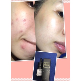 Serum đường đen BLACK SUGAR