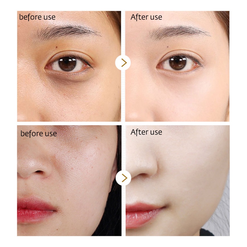 Hộp Serum Nhau Thai Cừu 30G Chống Lão Hóa Chống Nếp Nhăn Làm Trắng Da