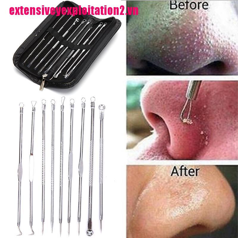 [Hàng mới về] Bộ 9 dụng cụ nặn mụn đầu đen và mụn trứng cá chất lượng cao