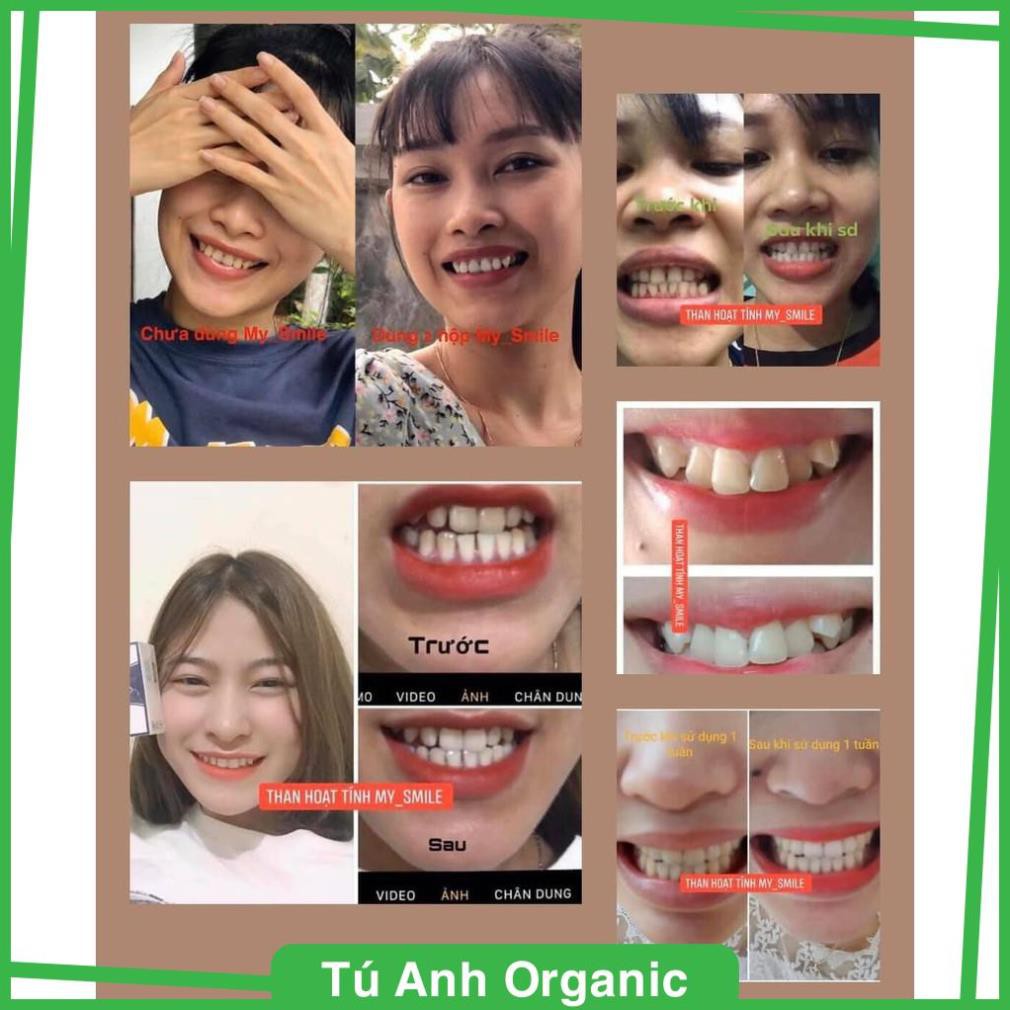 - Trắng răng than hoạt tính My Smile 70gr, bột đánh răng làm trắng răng từ than hoạt tính .
