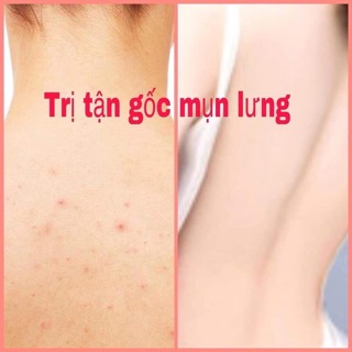 Sữa tắm than tre hoạt tính