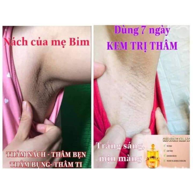 [CHÍNH HÃNG] SIÊU DƯỠNG THÂM 5S BIHO LADI | BigBuy360 - bigbuy360.vn