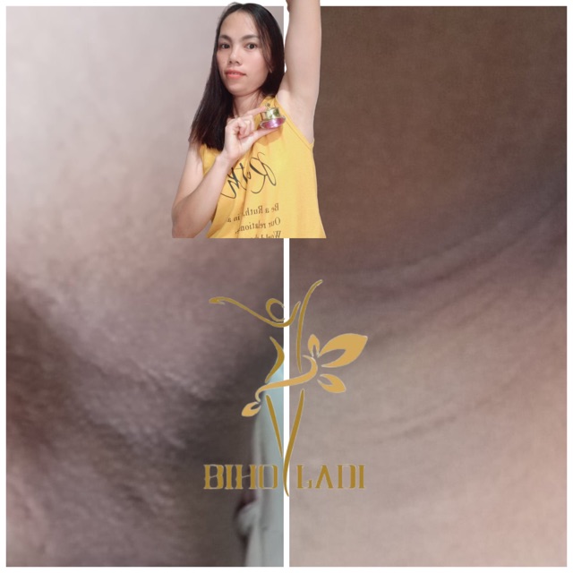 Combo BIHO LADI siêu dưỡng thâm 5s [mua 2 được 4] | BigBuy360 - bigbuy360.vn