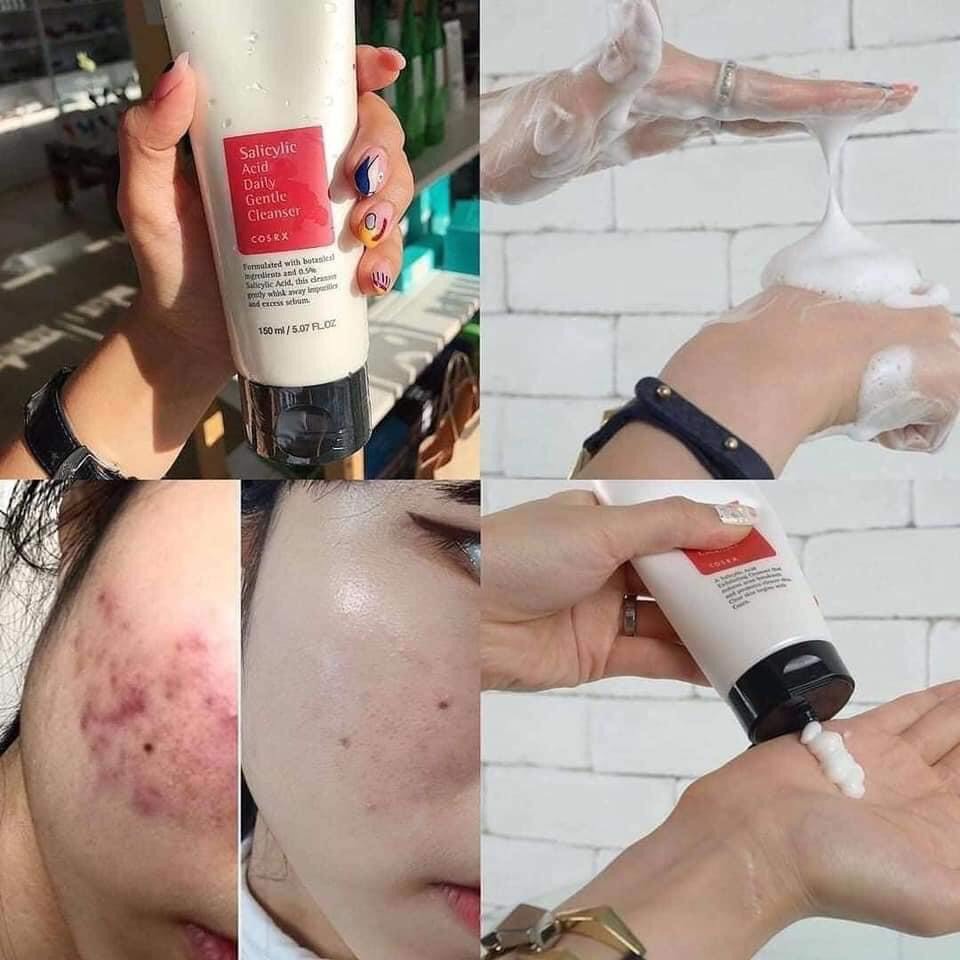 Sữa rửa mặt giảm mụn Cosrx Salicylic Acid TUÝP ĐỎ Daily