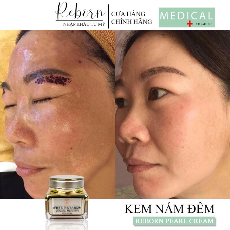 Kem Nám Đêm Reborn Dưỡng Trắng Dành Cho Da Nám_25gr