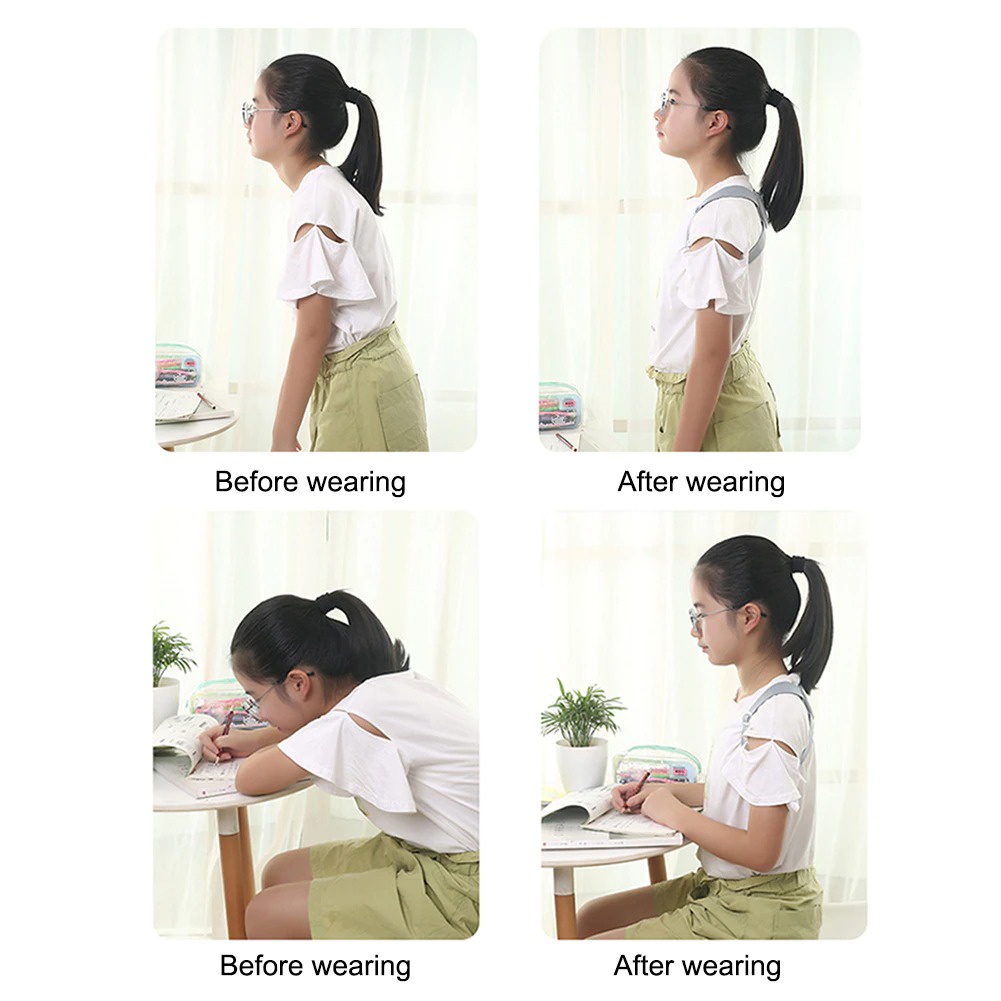 Đai Chống Gù Lưng Trẻ Em Thông Minh