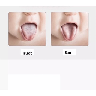Bộ vệ sinh lưỡi cho bé