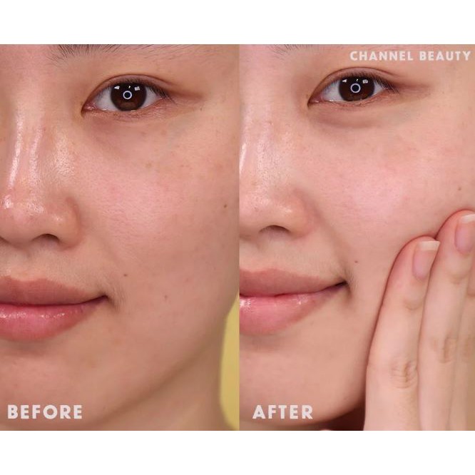 Gel Rửa Mặt Cho Da Dầu Mụn Làm Sạch Sâu, Giảm Nhờn Vichy Normaderm Phytosolution Intensive Purifying Gel 400ml