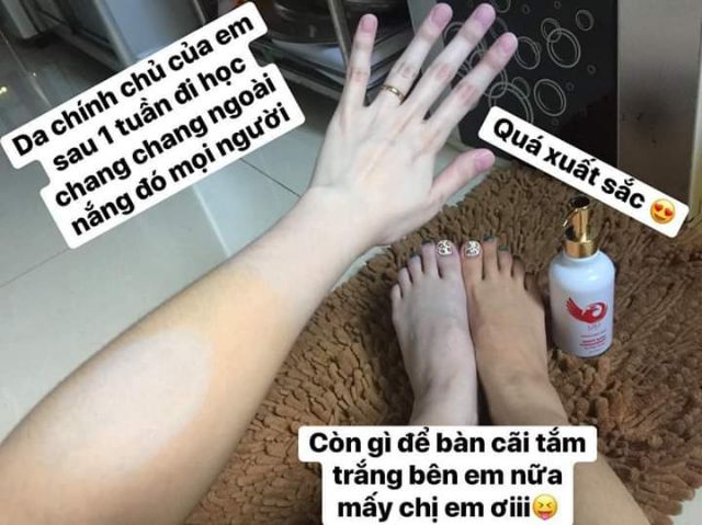 Ủ trắng Vĩnh viễn body GiGi kèm phiếu bảo hành | BigBuy360 - bigbuy360.vn