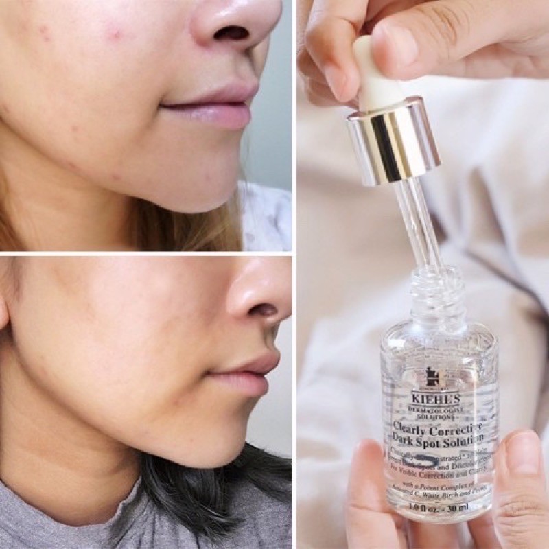 [Mã COS1904 giảm 8% đơn 300K] [Mini] Serum hỗ trợ giảm thâm Kiehl’s Dark Spot Solution 4ml | BigBuy360 - bigbuy360.vn
