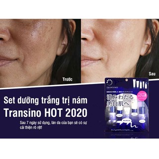 BỘ,SET TRANSINO MINI 5 MÓN NHẬT BẢN.